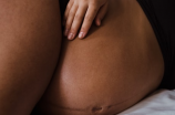 怀孕三个月肚子多大合适？